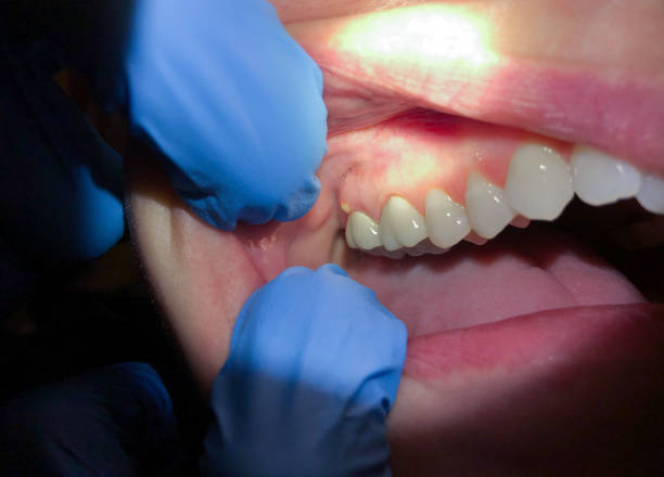 Best Emergency Dental Care for Abscessed Tooth in Alma, AR